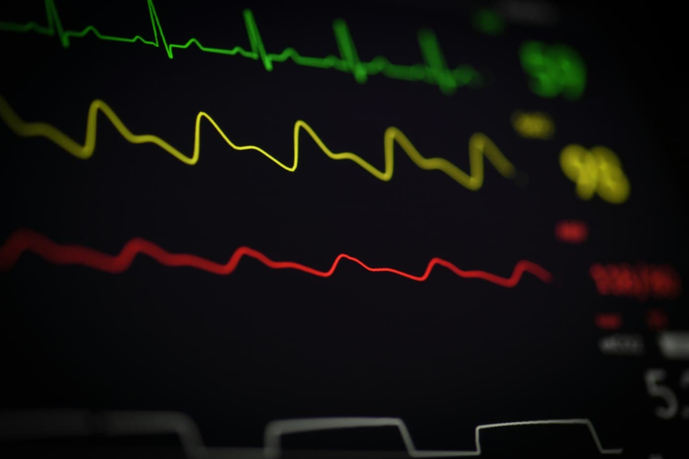 Patient monitor showing ECG, pulse oximetry, and arterial pressure waveforms